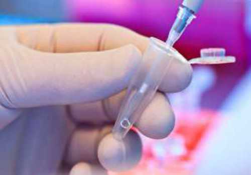 备孕心理压力大怎么办（备孕注意事项）