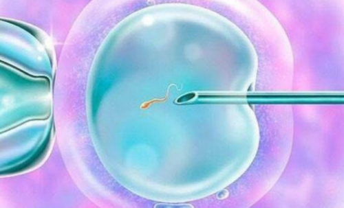 玉林试管婴儿费用多少钱？